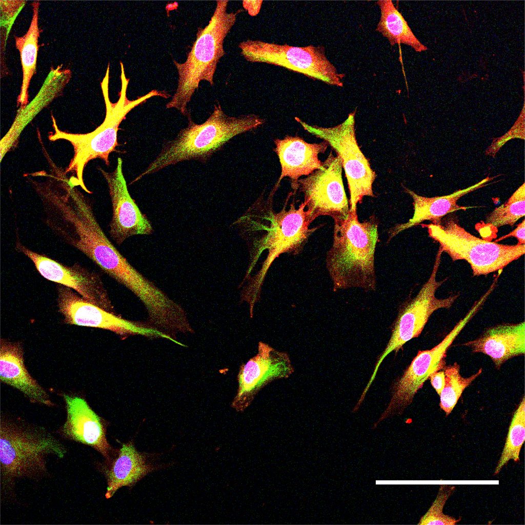 Long, thin,spiny cells stained yellow and blue appear above a black background