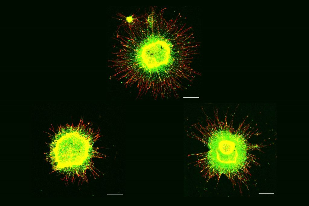 Three bright yellow-green celll cultures on black background