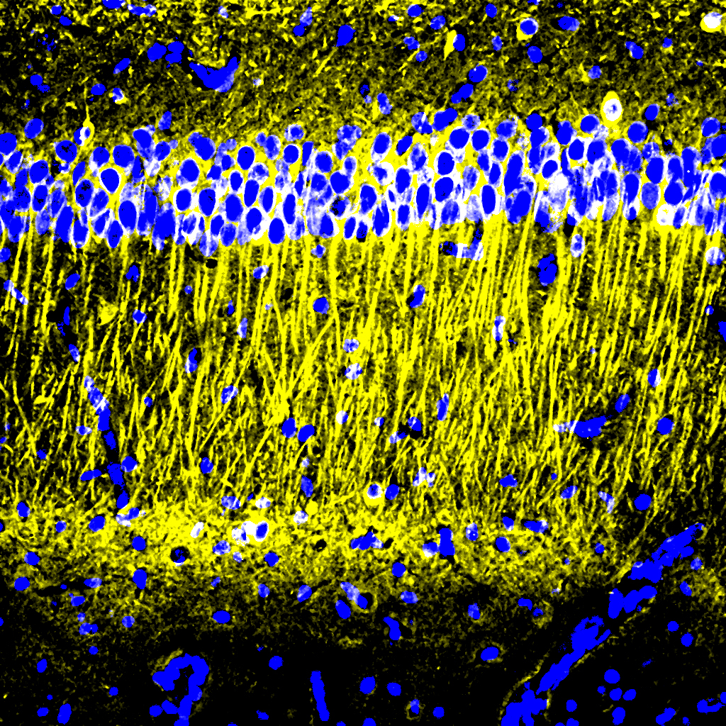 A square panel shows tall yellow streaks. At the very bottom is a black field with a few blue dots. Almost across the top there is a strip of many blue dots.