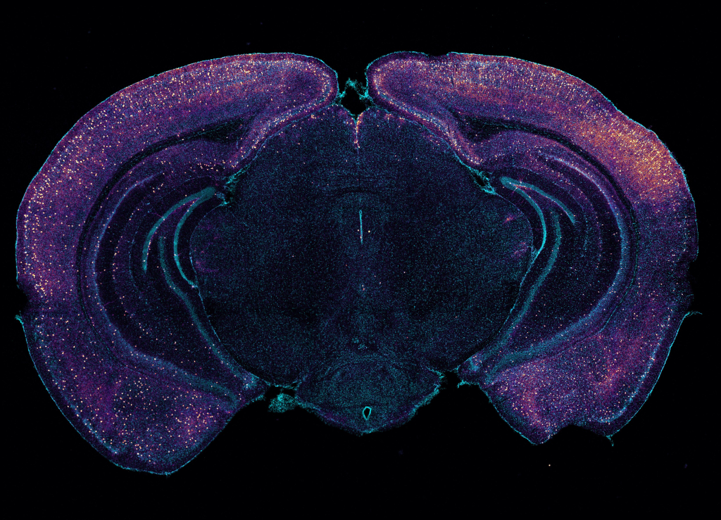 A coronal cross-section of a mouse brain is stained blue. The entire outer edge and occasional points further inside are speckled with yellow-green dots. The background behind the brain is black.