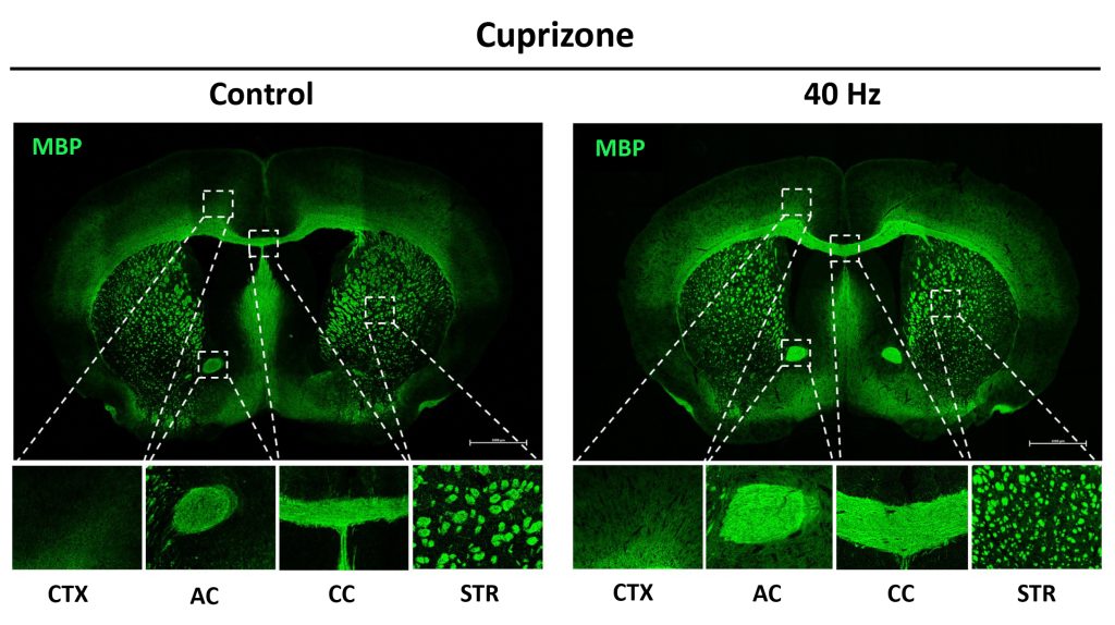 Two green-stained cross sections of a mouse brain, one labeled Cuprizone Control and one labeled Cuprizone 40Hz,, are accompanied by insets showing magnifications of parts specific brain regions. The green staining in each inset is greater and brighter in the 40Hz insets vs. the control insets.